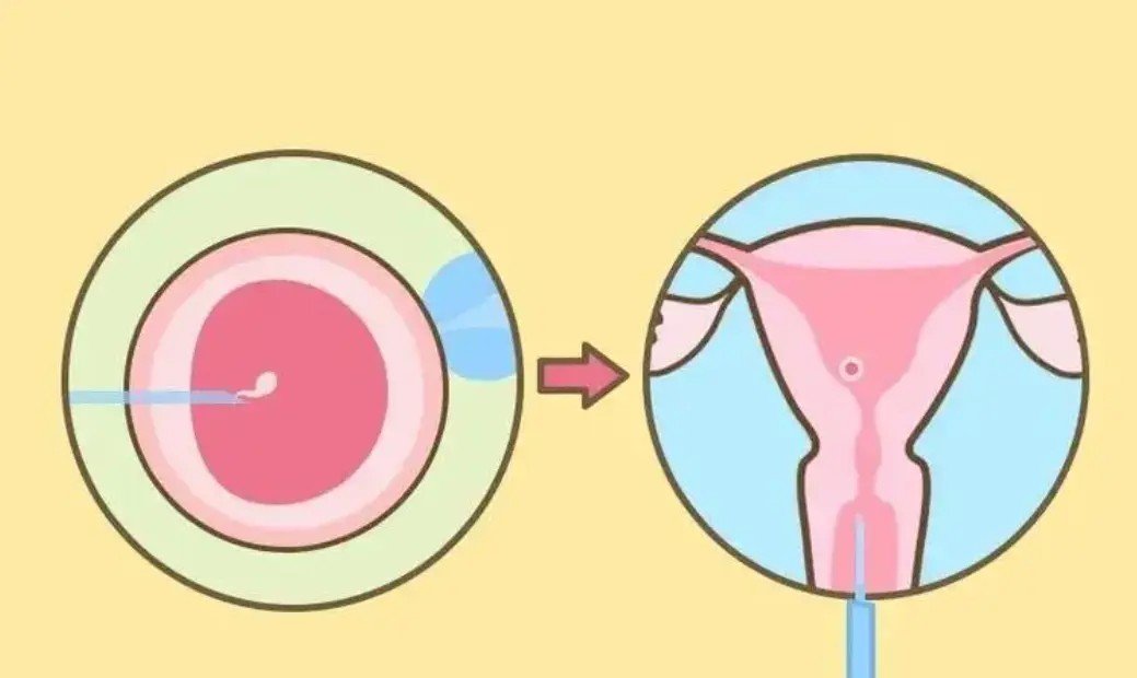 Embryo development in the IVF surrogacy process